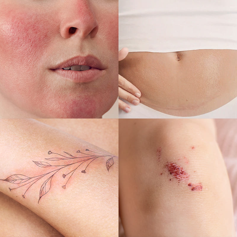 Cicabio Crème+ cobrindo mais de 25 indicações